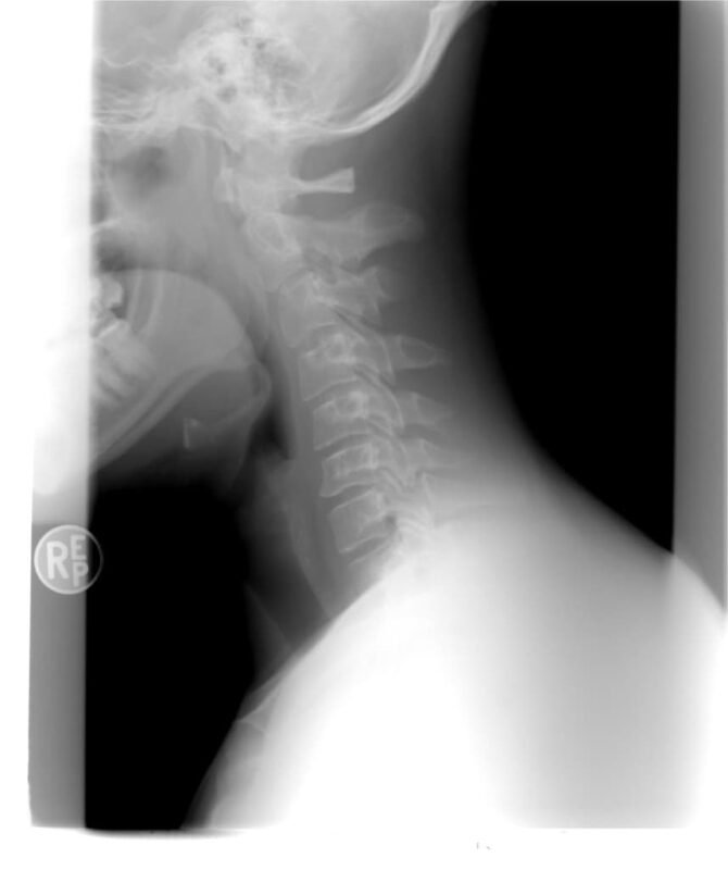 Cervicales