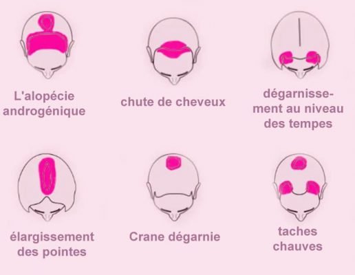 casque anti chute