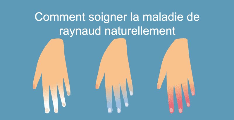 Comment soigner la maladie de raynaud naturellement